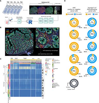 Exploring aryl hydrocarbon receptor expression and distribution in the tumor microenvironment, with a focus on immune cells, in various solid cancer types